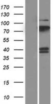Western Blot: PCPTP1 Overexpression Lysate (Adult Normal) [NBP2-10850] Left-Empty vector transfected control cell lysate (HEK293 cell lysate); Right -Over-expression Lysate for PCPTP1.