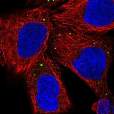 <b>Independent Antibodies Validation. </b>Immunocytochemistry/Immunofluorescence: PCSK1N Antibody [NBP2-49423] - Immunofluorescent staining of human cell line HEK 293 shows localization to vesicles.
