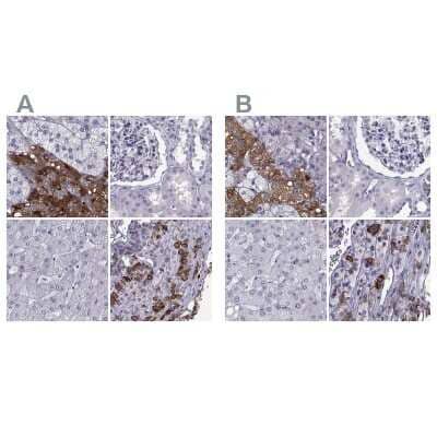 Immunohistochemistry-Paraffin: PCSK1N Antibody [NBP1-80797] - Staining of human adrenal gland, kidney, liver and pituitary gland using Anti-PCSK1N antibody NBP1-80797 (A) shows similar protein distribution across tissues to independent antibody NBP2-49423 (B).