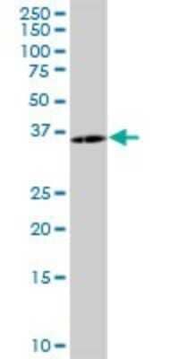 Western Blot: PCSK1N Antibody [H00027344-B01P] - Analysis of PCSK1N expression in rat brain.