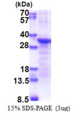 SDS-PAGE Recombinant Human PCSK1N His Protein