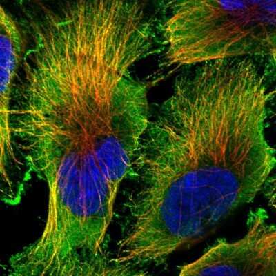 Immunocytochemistry/Immunofluorescence: PCTAIRE1 Antibody [NBP2-55219] - Staining of human cell line U-251 MG shows localization to plasma membrane, cytosol & microtubules.