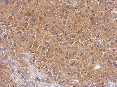 Immunohistochemistry-Paraffin: PCTAIRE1 Antibody [NBP2-19732] - Immunohistochemical analysis of paraffin-embedded U373 xenograft, using antibody at 1:500 dilution.