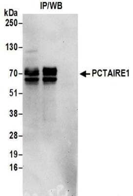 <b>Biological Strategies Validation. </b>Immunoprecipitation: PCTAIRE1 Antibody [NBP2-32254] - Samples:  Whole cell lysate (0.5 or 1.0 mg per IP reaction; 20% of IP loaded) prepared using NETN buffer from 293T cells.  Antibodies:  Affinity purified rabbit anti-PCTAIRE1 antibody NBP2-32254 used for IP at 6 ug per reaction. For blotting immunoprecipitated PCTAIRE1, NBP2-32254 was used at 0.4 ug/ml.  Detection: Chemiluminescence with an exposure time of 30 seconds.