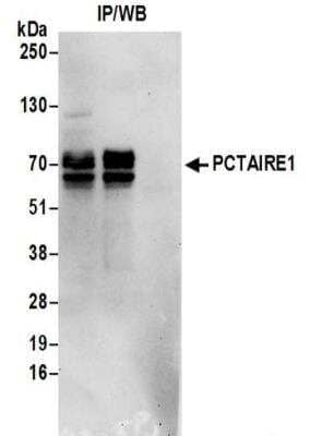 Immunoprecipitation: PCTAIRE1 Antibody [NBP2-32255] - Samples:  Whole cell lysate (0.5 or 1.0 mg per IP reaction; 20% of IP loaded) prepared using NETN buffer from 293T cells. Antibodies:  Affinity purified rabbit anti-PCTAIRE1 antibody NBP2-32255 used for IP at 6 ug per reaction. For blotting immunoprecipitated PCTAIRE1 was used at 0.4 ug/ml.  Detection: Chemiluminescence with an exposure time of 30 seconds.