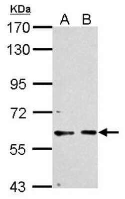 Western Blot: PCTAIRE1 Antibody [NBP2-19732] - Sample (30 ug of whole cell lysate) A: Neuro2A B: GL261 7. 5% SDS PAGE gel, diluted at 1:1000.