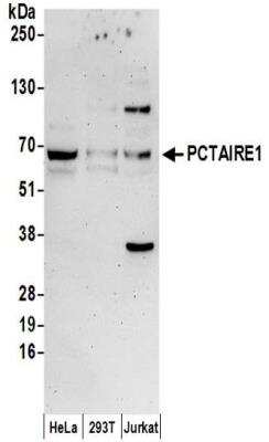 Western Blot: PCTAIRE1 Antibody [NBP2-32254] - Samples:  Whole cell lysate (50 ug) prepared using NETN buffer from HeLa, 293T, and Jurkat cells. Antibodies:  Affinity purified rabbit anti-PCTAIRE1 antibody NBP2-32254 used for WB at 0.1 ug/ml.  Detection: Chemiluminescence with an exposure time of 3 minutes.