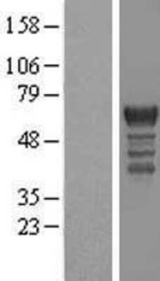 Western Blot: PCTAIRE1 Overexpression Lysate (Adult Normal) [NBL1-14194] Left-Empty vector transfected control cell lysate (HEK293 cell lysate); Right -Over-expression Lysate for PCTAIRE1.