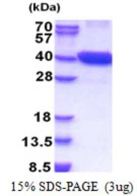 SDS-Page: PCTAIRE1 Protein [NBP2-22971]