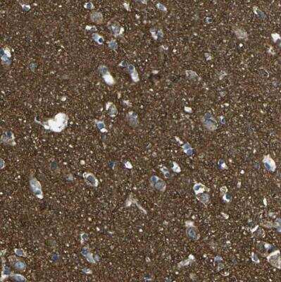 Immunohistochemistry-Paraffin: PCTAIRE2 Antibody [NBP1-87316] -  Staining of human cerebral cortex shows moderate to strong cytoplasmic positivity in neuropil.