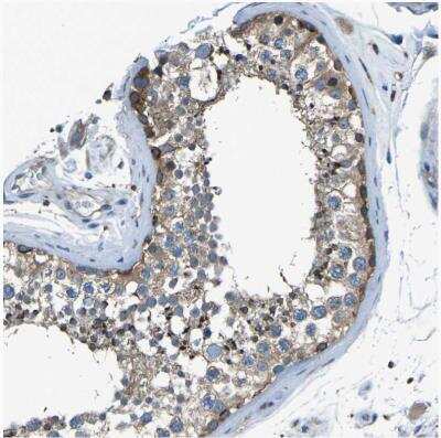 Immunohistochemistry-Paraffin: PCTAIRE2 Antibody [NBP1-87316] -  Staining of human testis shows moderate to strong cytoplasmic positivity in cells in seminiferous ducts.