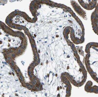 Immunohistochemistry-Paraffin: PCTAIRE2 Antibody [NBP1-87316] -   Staining of human placenta shows moderate to strong cytoplasmic positivity in trophoblastic cells.