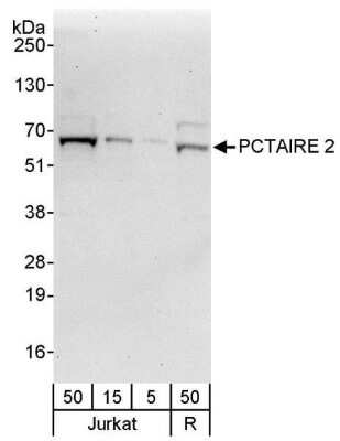 Western Blot: PCTAIRE2 Antibody [NBP1-42688] - Whole cell lysate from Jurkat (5, 15 and 50 ug) and Ramos (R; 50 ug) cells. Antibody used at 0.4 ug/ml.