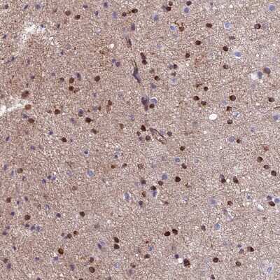 Immunohistochemistry-Paraffin: PCTAIRE3 Antibody [NBP1-92249] - Staining of human cerebral cortex shows moderate to strong cytoplasmic positivity in glial cells.
