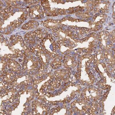 Immunohistochemistry-Paraffin: PCTAIRE3 Antibody [NBP1-92249] - Staining of human seminal vesicle shows moderate cytoplasmic positivity in glandular cells.