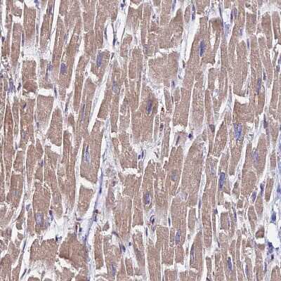 Immunohistochemistry-Paraffin: PCTAIRE3 Antibody [NBP1-92249] - Staining of human heart muscle shows moderate cytoplasmic positivity in cardiomyocytes.