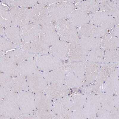 Immunohistochemistry-Paraffin: PCTAIRE3 Antibody [NBP1-92249] - Staining of human skeletal muscle shows very weak positivity in myocytes as expected.