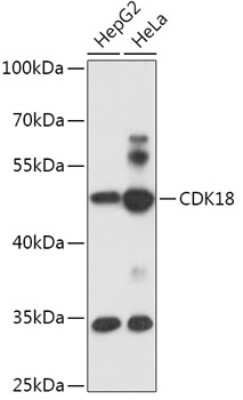 Western Blot PCTAIRE3 Antibody - Azide and BSA Free