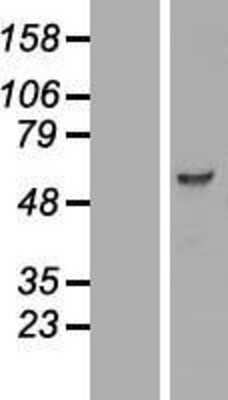 Western Blot: PCTAIRE3 Overexpression Lysate (Adult Normal) [NBP2-10841] Left-Empty vector transfected control cell lysate (HEK293 cell lysate); Right -Over-expression Lysate for PCTAIRE3.