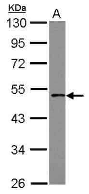 Western Blot: PCYT1B Antibody [NBP2-19734] - Sample (30 ug of whole cell lysate) A: IMR32 10% SDS PAGE gel, diluted at 1:1000.
