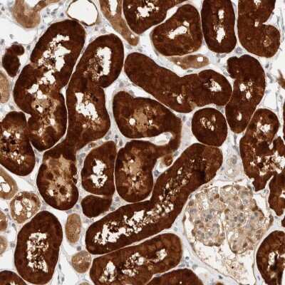 Immunohistochemistry-Paraffin: PCYT2 Antibody [NBP1-83951] - Staining of human Kidney shows strong granular cytoplasmic positivity in cells in tubules.