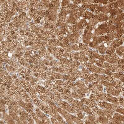 Immunohistochemistry-Paraffin: PCYT2 Antibody [NBP1-83951] - Staining of human Liver shows strong granular cytoplasmic positivity in hepatocytes.