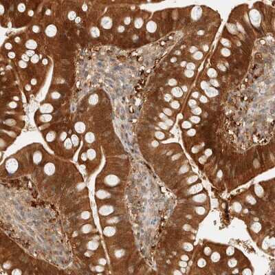 Immunohistochemistry-Paraffin: PCYT2 Antibody [NBP1-83951] - Staining of human Small intestine shows strong granular cytoplasmic positivity in glandular cells.