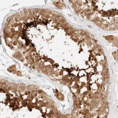 Immunohistochemistry-Paraffin: PCYT2 Antibody [NBP1-83951] - Staining of human Testis shows strong granular cytoplasmic positivity in cells in seminiferous ducts and Leydig cells.