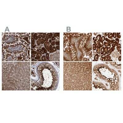 Immunohistochemistry-Paraffin: PCYT2 Antibody [NBP1-83952] - Staining of human gastrointestinal, kidney, liver and testis using Anti-PCYT2 antibody NBP1-83952 (A) shows similar protein distribution across tissues to independent antibody NBP1-83951 (B).