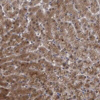 Immunohistochemistry-Paraffin: PCYT2 Antibody [NBP1-83952] - Staining of human Liver shows strong granular cytoplasmic positivity in hepatocytes.