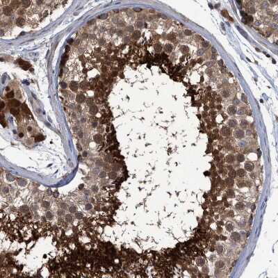 Immunohistochemistry-Paraffin: PCYT2 Antibody [NBP1-83952] - Staining of human testis shows strong granular cytoplasmic positivity in cells in seminiferous ducts and Leydig cells.