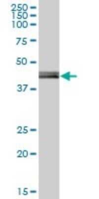 Western Blot: PCYT2 Antibody [H00005833-B01P] - Analysis of PCYT2 expression in human liver.