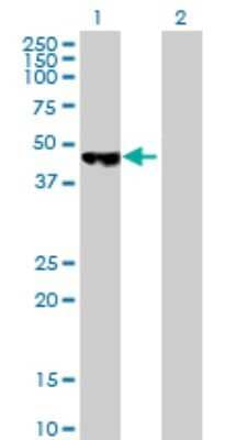 Western Blot: PCYT2 Antibody [H00005833-B01P] - Analysis of PCYT2 expression in transfected 293T cell line by PCYT2 polyclonal antibody.  Lane 1: PCYT2 transfected lysate(42.79 KDa). Lane 2: Non-transfected lysate.