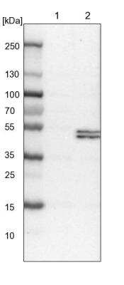 Western Blot: PCYT2 Antibody [NBP1-83952] - Lane 1: NIH-3T3 cell lysate (Mouse embryonic fibroblast cells). Lane 2: NBT-II cell lysate (Rat Wistar bladder tumor cells).