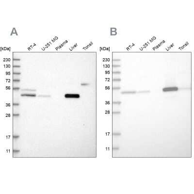 <b>Independent Antibodies Validation. </b>Western Blot: PCYT2 Antibody [NBP1-83952] - Analysis using Anti-PCYT2 antibody NBP1-83952 (A) shows similar pattern to independent antibody NBP1-83951 (B).