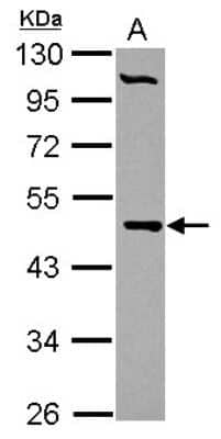 Western Blot: PCYT2 Antibody [NBP2-19735] - Sample (30 ug of whole cell lysate) A: HepG2 10% SDS PAGE gel, diluted at 1:1000.