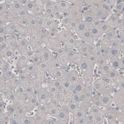 Immunohistochemistry: PD-1 Antibody (CL3624) [NBP2-61625] - Staining of human liver shows absence of immunoreactivity (negative control).