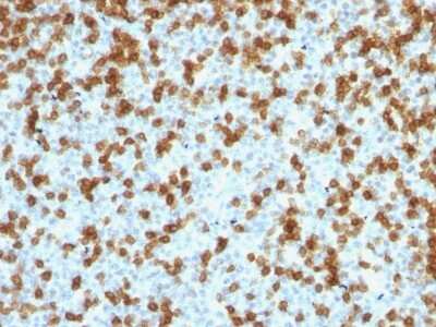Immunohistochemistry-Paraffin: PD-1 Antibody (PDCD1/1410R) [NBP2-53209] - Formalin-fixed, paraffin-embedded human Tonsil stained with PD1 (CD279) Recombinant Rabbit Monoclonal Antibody (PDCD1/1410R).