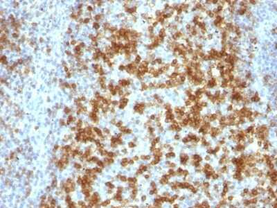 Immunohistochemistry-Paraffin: PD-1 Antibody (PDCD1/922) [NBP2-44398] - Human Tonsil stained with PD1 (CD279) Monoclonal Antibody (PDCD1/922).