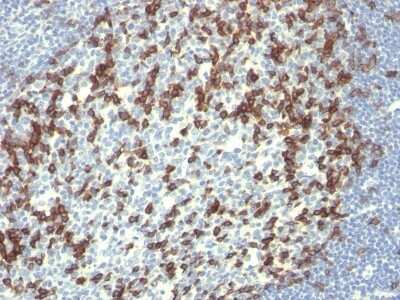 Immunohistochemistry-Paraffin: PD-1 Antibody (PDCD1/922) [NBP2-44398] - Human Tonsil stained with PD1 (CD279) Monoclonal Antibody (PDCD1/922).