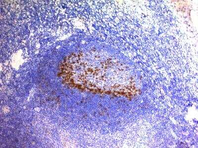 Immunohistochemistry-Paraffin: PD-1 Antibody (SPM597) - IHC-Prediluted [NBP2-48286] - Human Tonsil stained with PD1 (CD279) Monoclonal Antibody (SPM597).