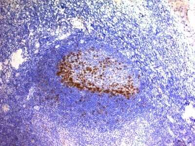 Immunohistochemistry-Paraffin: PD-1 Antibody (SPM597) [NBP2-44399] - Human Tonsil stained with PD1 (CD279) Monoclonal Antibody (SPM597).
