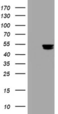 Western Blot: PD-ECGF/Thymidine Phosphorylase Antibody (OTI7A6) - Azide and BSA Free [NBP2-73300] - Analysis of HEK293T cells were transfected with the pCMV6-ENTRY control (Left lane) or pCMV6-ENTRY PD-ECGF/Thymidine Phosphorylase.