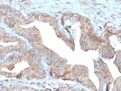 Immunohistochemistry-Paraffin: PD-ECGF/Thymidine Phosphorylase Antibody (rTYMP/3444) - Azide and BSA Free [NBP3-08359] - Formalin-fixed, paraffin-embedded human Placenta stained with PD-ECGF/Thymidine Phosphorylase Recombinant Mouse Monoclonal Antibody (rTYMP/3444).