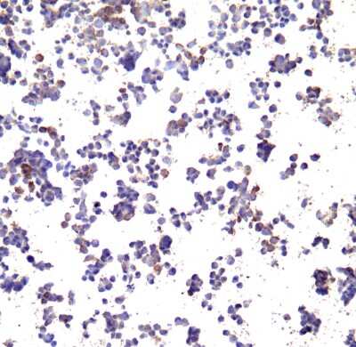 Immunocytochemistry/Immunofluorescence: PD-L1 Antibody (F6A9) - VHH [NBP3-12825] - Immunocytochemistry of PD-L1 in transfected 293 cells with PD-L1 antibody at 10 ug/ml.