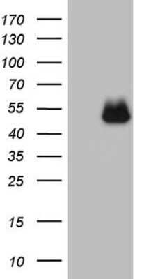 Western Blot: PD-L2/B7-DC/PDCD1LG2 Antibody (OTI7B10) - Azide and BSA Free [NBP2-73306] - Analysis of HEK293T cells were transfected with the pCMV6-ENTRY control (Left lane) or pCMV6-ENTRY PDCD1LG2.