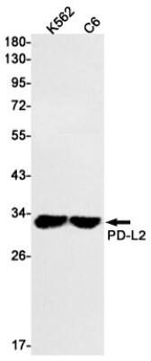 Western Blot: PD-L2/B7-DC/PDCD1LG2 Antibody (S02-2A1) [NBP3-19490] - Western blot detection of PD-L2/B7-DC/PDCD1LG2 in K562, C6 cell lysates using NBP3-19490 (1:1000 diluted). Predicted band size: 31kDa. Observed band size: 31kDa.