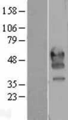 Western Blot: PD1 Overexpression Lysate (Adult Normal) [NBP2-04279] Left-Empty vector transfected control cell lysate (HEK293 cell lysate); Right -Over-expression Lysate for PD1.