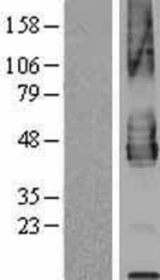 Western Blot PD-L2/B7-DC/PDCD1LG2 Overexpression Lysate