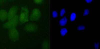 Immunocytochemistry/Immunofluorescence: PDCD4 Antibody (JA80-83) [NBP2-67024] - Staining PDCD4 in A431 cells (green). The nuclear counter stain is DAPI (blue). Cells were fixed in paraformaldehyde, permeabilised with 0.25% Triton X100/PBS.